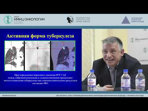 Видео: ПЭТ/КТ в диагностике рака легкого