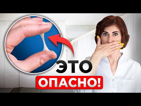 Видео: Как сохранить беременность? Не пропусти ЭТИ сигналы!