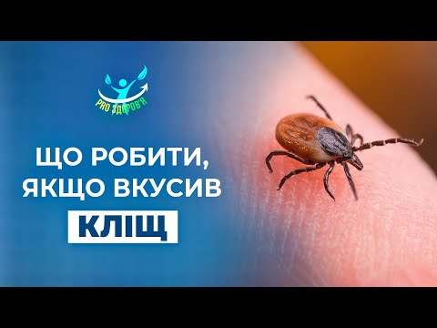 Видео: Як витягнути кліща, що робити, якщо залишилась голова, улюблені місця кліща на тілі | PRO здоров'я