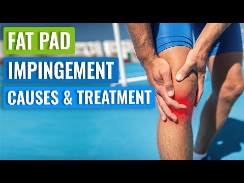 Видео: Синдром ущемления жировой прослойки коленного сустава (Гоффа) — причины и лечение