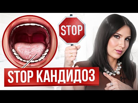 Видео: ВОТ, как НЕЛЬЗЯ лечить кандидоз – 4 ошибки. Как избавиться от кандиды?