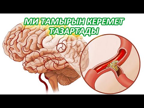 Видео: МИДЫҢ ТАМЫРЛАРЫН 5 ӘДІСПЕН ЖУЫП ТАЗАЛАЙМЫЗ, Керекмет әдіс, Керек арнасы