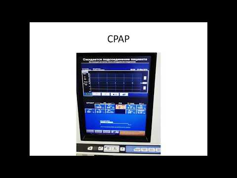 Видео: Искусственная вентиляция лёгких (3 часть)