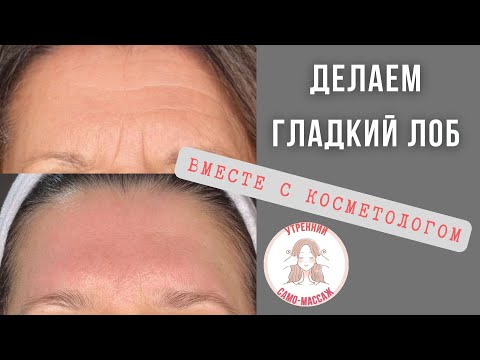 Видео: Миофасциальный само-массаж лба. Гуаша. Профессиональные приемы для подбородка, шеи, декольте. V-овал