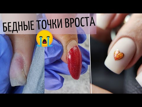 Видео: Точки вроста ПОСТРАДАЛИ от переношенных ногтей 😭 СЕРДЕЧКИ на ногтях ❤️ Маникюр на 14 февраля.
