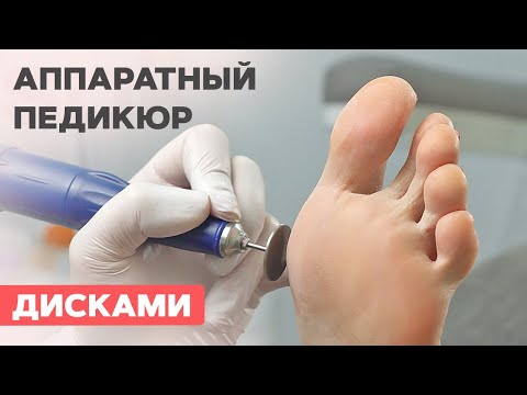 Видео: Аппаратный педикюр дисками за 20 минут! Реально?