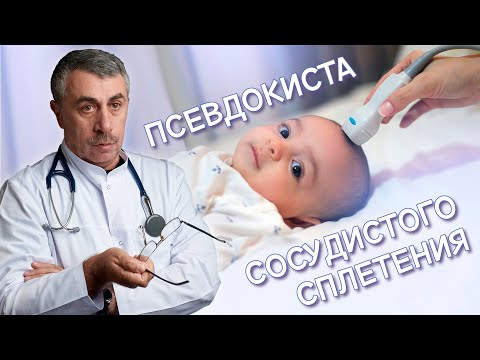 Видео: Псевдокиста сосудистого сплетения - Доктор Комаровский