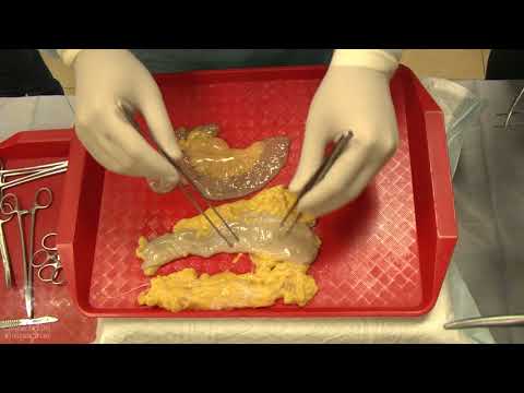 Видео: Формирование межкишечного анастомоза. Специально для СНК Эскулап