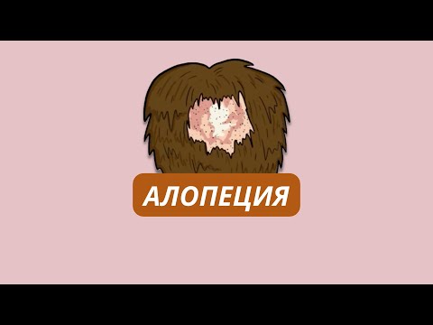 Видео: Из-за чего появляется алопеция? Типы, причины и терапия.