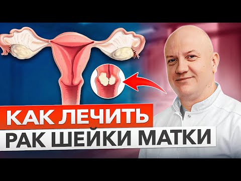 Видео: Вот что нужно знать про РАК ШЕЙКИ МАТКИ!