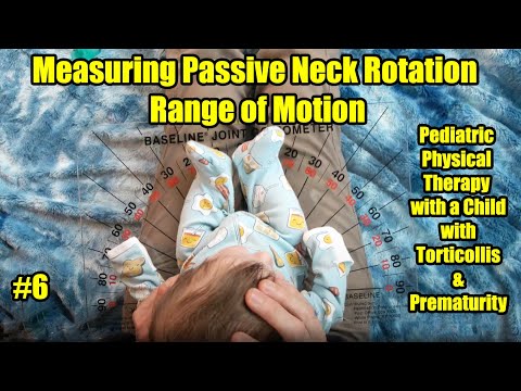 Видео: # 6 Измерение вращения шеи: педиатрическая физиотерапия с ребенком с кривошеей и недоношенностью
