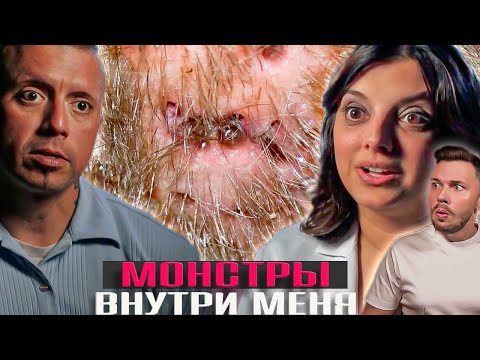 Видео: Это сьедало ее заживо ► Монстры внутри меня Сезон 8 / 1