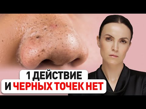 Видео: ЭТО ГЛАВНЫЕ ошибки ухода, из-за которых появляются черные точки