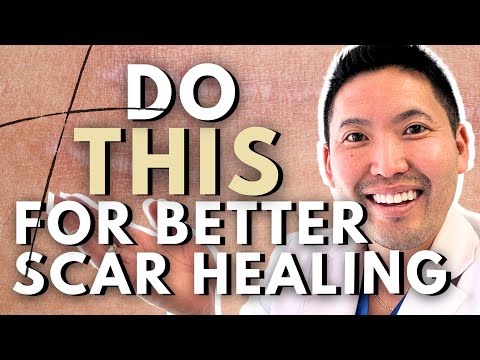 Видео: Как лечить шрамы, как дерматолог
