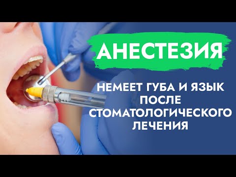 Видео: Анестезия. Немеет губа и язык после стоматологического лечения.