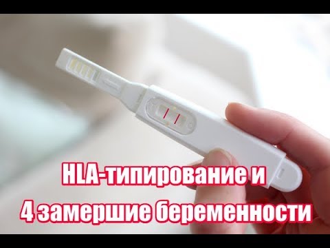 Видео: HLA-типирование и 4 замершие беременности. Гаплотипы HLA и вынашивание беременности