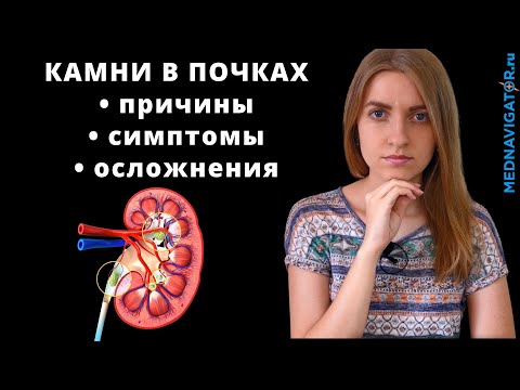 Видео: Камни в почках - мочекаменная болезнь (МКБ) | Причины, симптомы, осложнения | Mednavigator.ru
