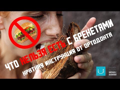 Видео: Влог Ортодонта #4 - Что нельзя есть с брекетами?