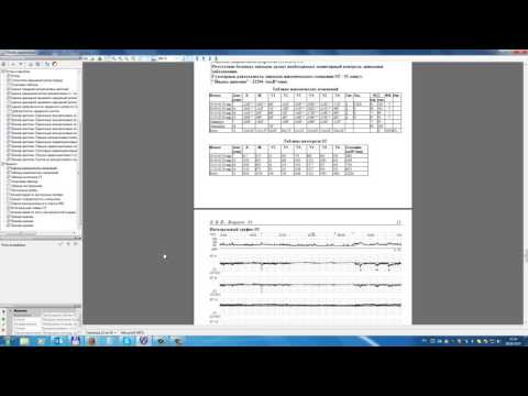 Видео: Result3. Страница «Оценка ишемических изменений», ишемические аритмии.