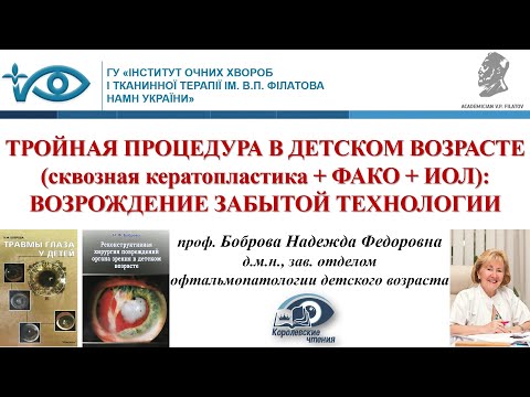 Видео: СКВОЗНАЯ КЕРАТОПЛАСТИКА + ФАКО + ИОЛ ("ТРОЙНАЯ ПРОЦЕДУРА") У ДЕТЕЙ: ВОЗРОЖДЕНИЕ ЗАБЫТОЙ ТЕХНОЛОГИИ