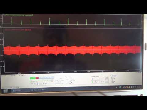 Видео: ВАЗ 2111 троит.   Проверка системы зажигания COP осциллографом мотортестером Диамаг-2.