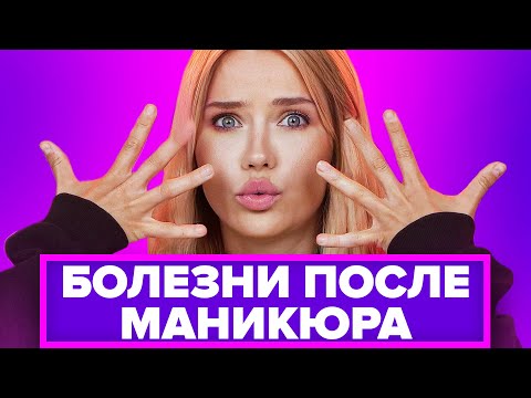 Видео: БОЛЕЗНИ ПОСЛЕ МАНИКЮРА