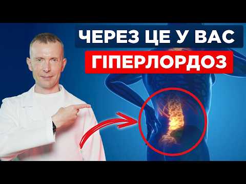 Видео: ГІПЕРЛОРДОЗ | Випираючий живіт, болить спина | Чудо-вправа для виконання вдома!