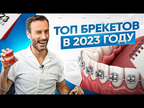 Видео: Как выбрать брекеты в 2023 году? Сколько стоят самые ходовые варианты