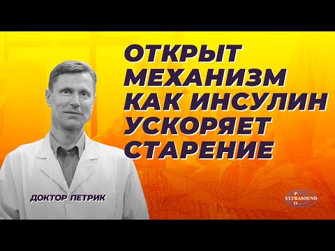 Видео: Открыт механизм как инсулин ускоряет старение