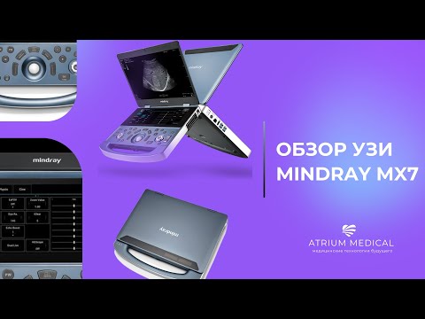 Видео: АЙФОН СРЕДИ УЗИ. Обзор УЗИ аппарата Mindray МХ7