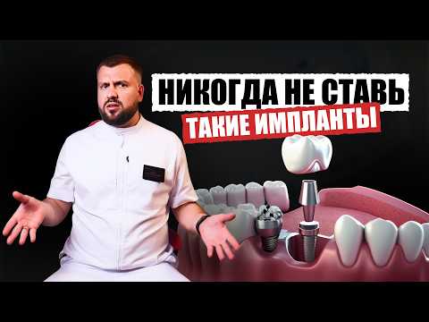 Видео: Почему имплант не прижился? Всё начинается с неправильного выбора