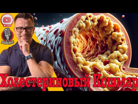 Видео: Все пропитано ХОЛЕСТЕРИНОМ! Атеросклероз, бляшки и закупоренные сосуды!