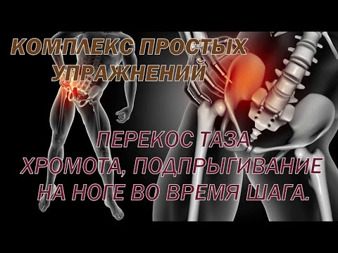 Видео: Перекос таза, хромота, подпрыгивание на ноге во время шага. Простые упражнения для решения проблемы.
