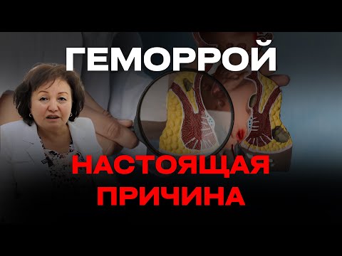 Видео: ГЕМОРРОЙ: НАСТОЯЩАЯ ПРИЧИНА