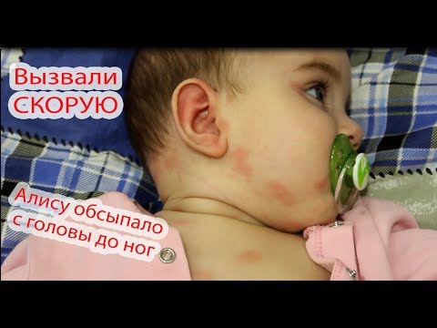 Видео: VLOG Вызвали СКОРУЮ. Алису обсыпало