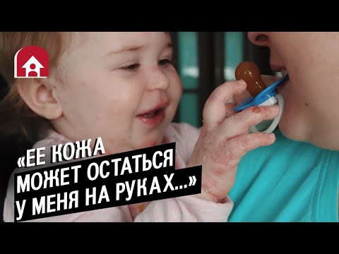 Видео: Мою дочь ранит любое прикосновение: Женя | Быть мамой