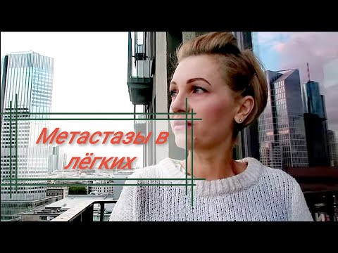 Видео: МЕТАСТАЗЫ В ЛЁГКИХ. КТ Сентябрь 2020