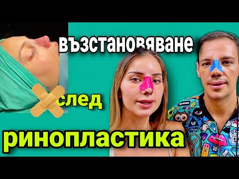 Видео: НАПРАВИХМЕ СИ РИНОПЛАСТИКА ЗАЕДНО