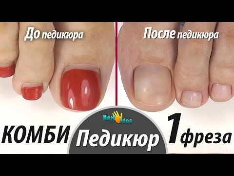 Видео: ПЕДИКЮР гель лаком КОМБИ 1 фрезой. Техника "Эстетик" Укрепление каучуковой базой. Наращивание углов.