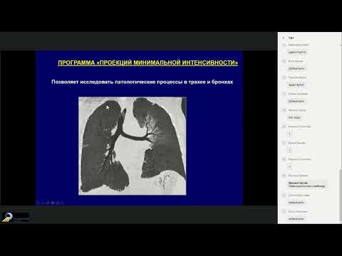 Видео: Компьютерная томография воздухопроводящих путей в норме и патологии