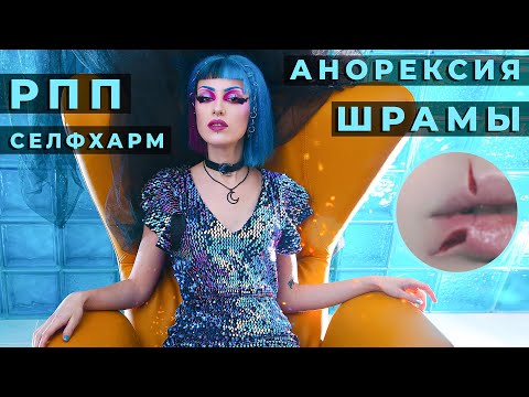 Видео: 10 ФАКТОВ О МОЁМ ТЕЛЕ / Анорексия, РПП, жуткие шрамы на лице