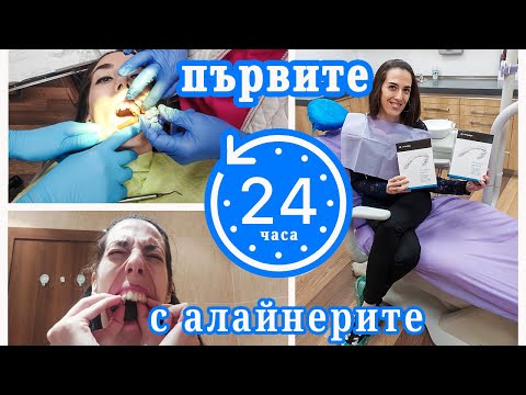 Видео: Първите 24 часа с алайнерите на Invisalign - ep. 3