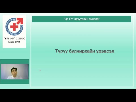 Видео: Түрүү булчирхайн үрэвсэл ба ангилал