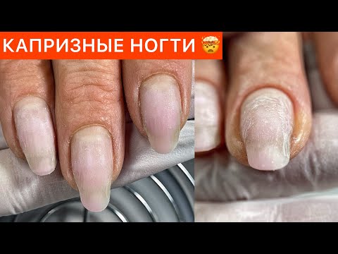 Видео: СКРУЧИВАЮТСЯ НОГТИ 💅 ОТСЛОЙКИ ОТ КУТИКУЛЫ И ОТСУТСТВИЕ КАРМАНА 🫠