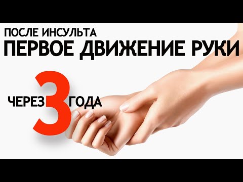 Видео: ПЕРВОЕ ДВИЖЕНИЕ РУКИ ЧЕРЕЗ ТРИ ГОДА ПОСЛЕ ИНСУЛЬТА.