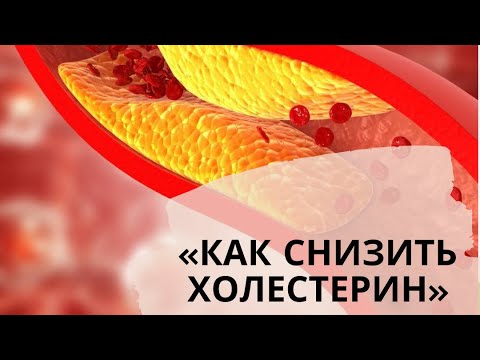 Видео: «Как снизить холестерин»