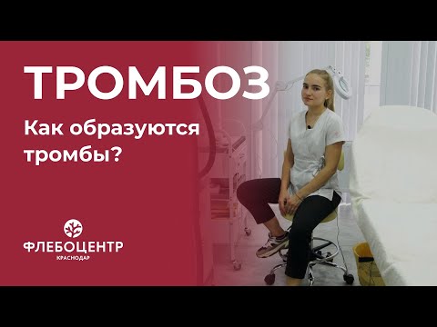 Видео: 🔴 Тромбоз. Как образуются тромбы в венозной системе?