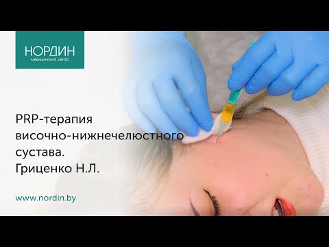 Видео: Плазмотерапия височно-нижнечелюстного сустава