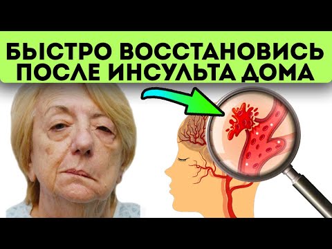 Видео: Вот как старые врачи тайно восстанавливаются после инсульта