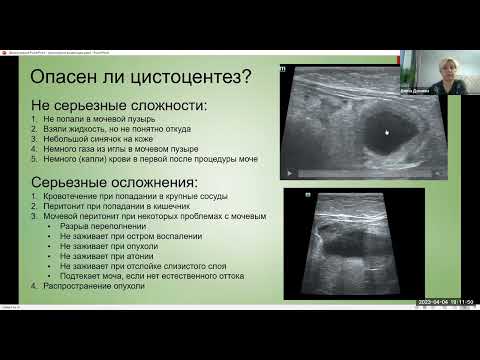 Видео: «Цистоцентез пункция мочевого пузыря под контролем УЗИ» Дунаева Е П  ИВЦ